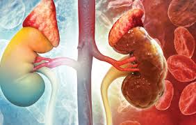 Youth's death case due to kidney failure